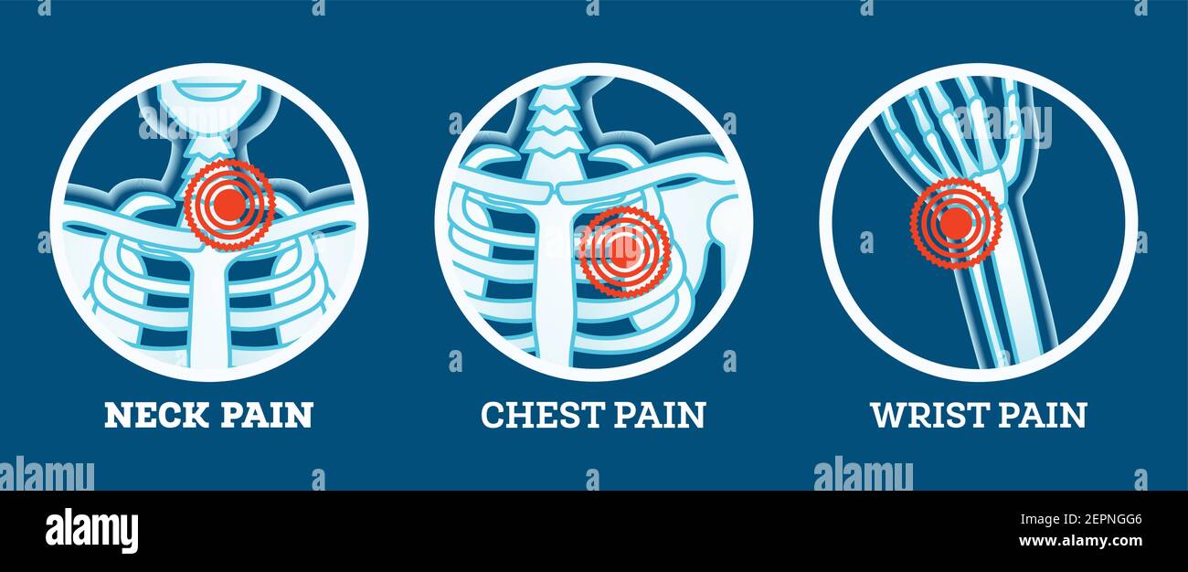 Körperschmerzen. Symbole Eingestellt. Schmerzen in Nacken, Brust und Handgelenk. Frauen und Männer Körperteile. Vektorgrafik. Stock Vektor