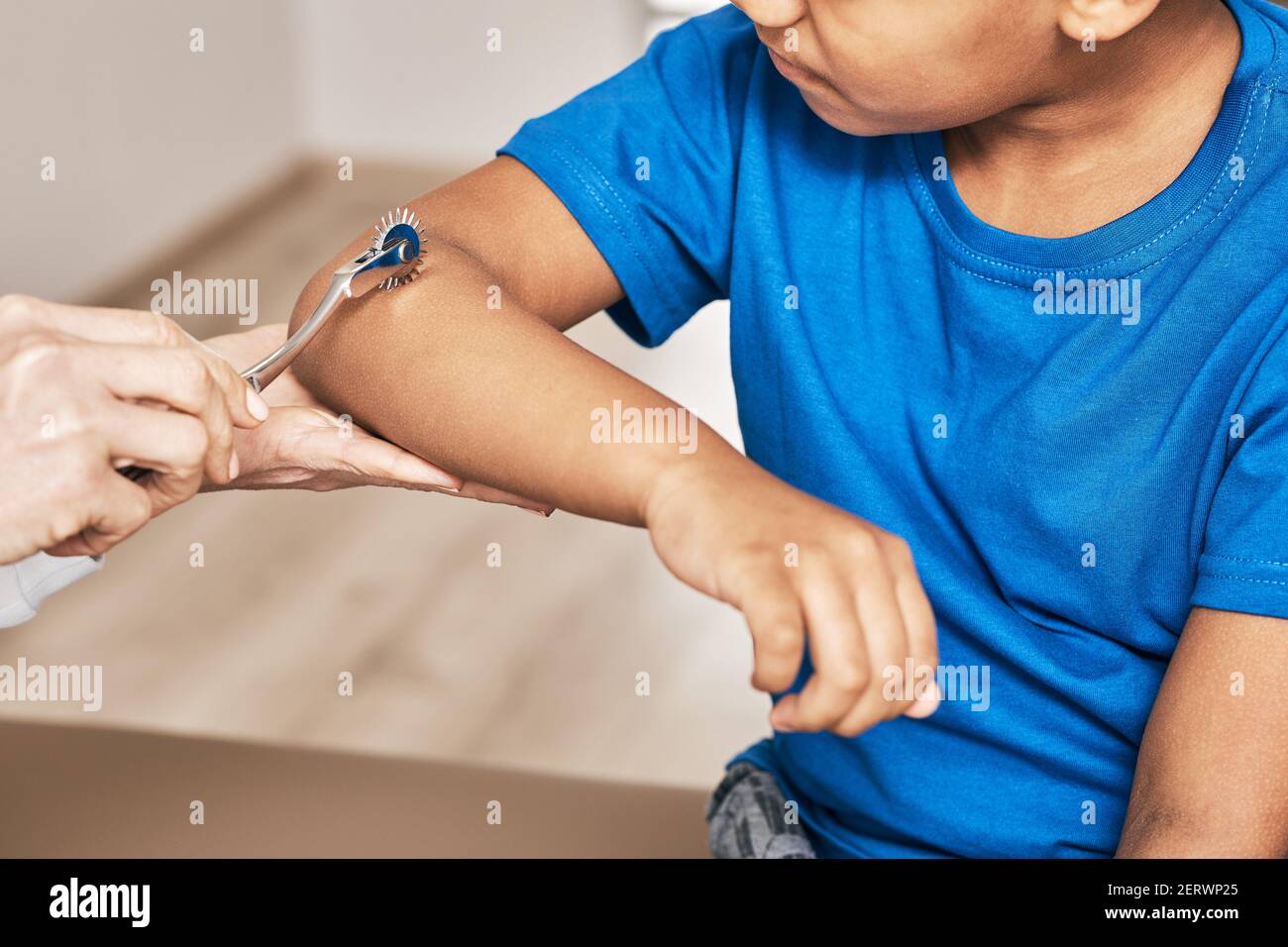 Der Arzt benutzt ein neurologisches Wartenberg-Nadelrad für die Untersuchung der Handreflexe eines Kindes. Neurologie, Nahaufnahme Stockfoto