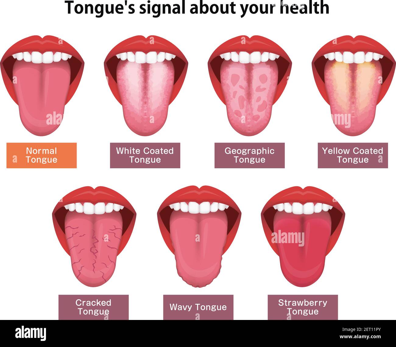Zunge Gesundheit Zeichen Vektor Illustration Set Stock Vektor