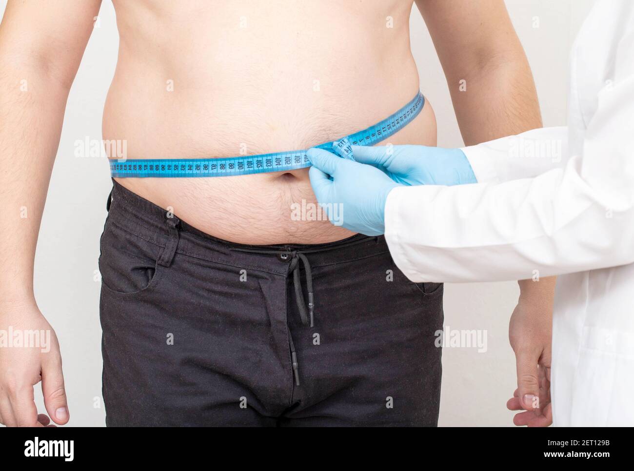 Der Arzt Ernährungsberater misst den dicken Bauch eines männlichen Patienten mit einem Maßband. Gewichtsverlust und gesunde Lebensweise Konzept Stockfoto