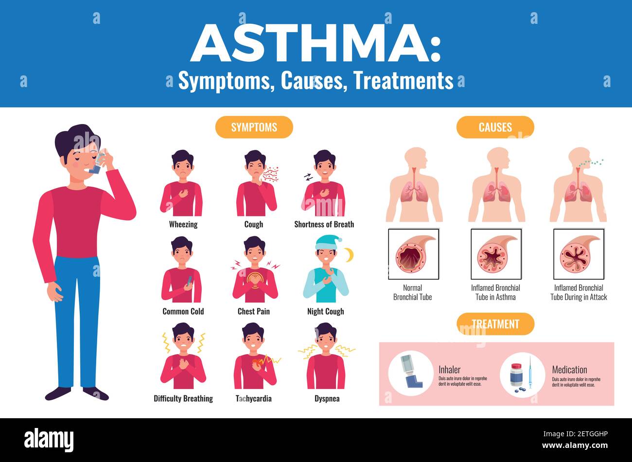 Asthma-Symptome verursacht Behandlung flach medizinisches Poster mit Patienten halten Inhalator und entzündete Bronchialröhrchen Vektor-Illustration Stock Vektor