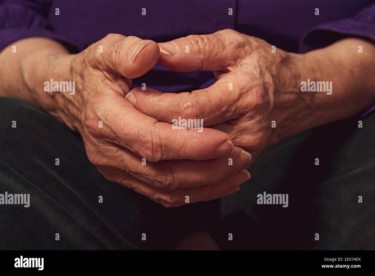 Alte kaukasische Frau Hände. Nahaufnahme. Hartes Leben alter Menschen. Krankheiten Im Alter. Venen und Hautpigmentierung. Totale Einsamkeit im Alter. Stockfoto