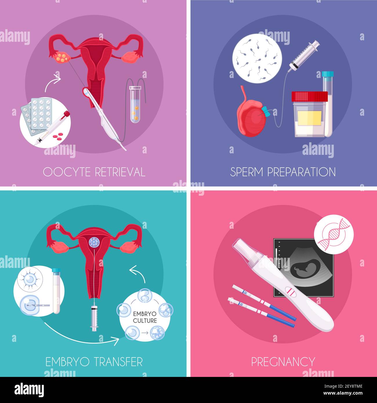 Vier Quadrate flach in vitro Fertilisation IVF Icon Set mit Oozytr ...