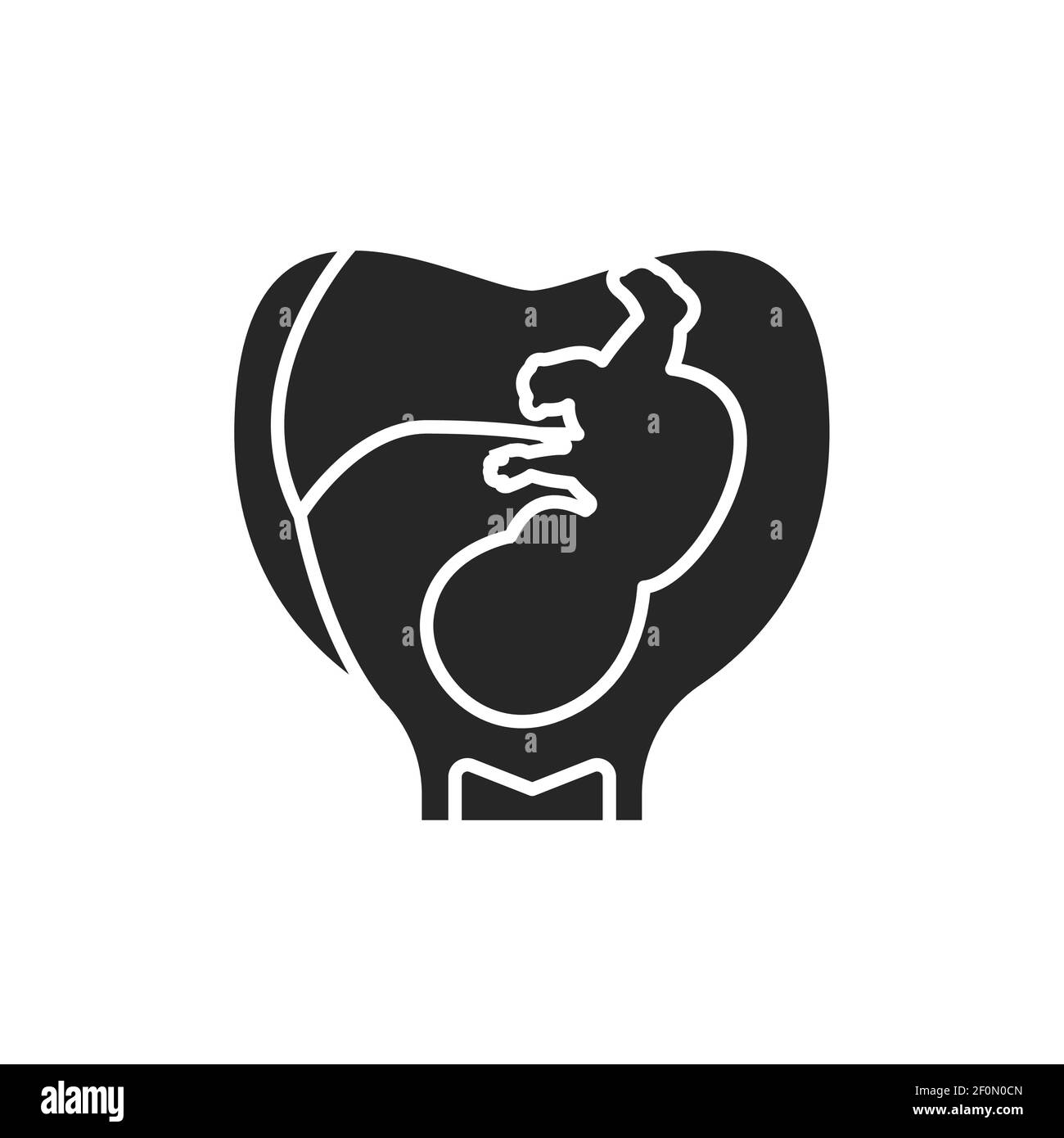 Schwangerschaft Stadium Embryo in uterus mit Nabelschnur schwarz Glyph Symbol. Wachstum Fötus Entwicklung. Piktogramm für Webseite, mobile App. UI UX GUI DESIGN Stock Vektor