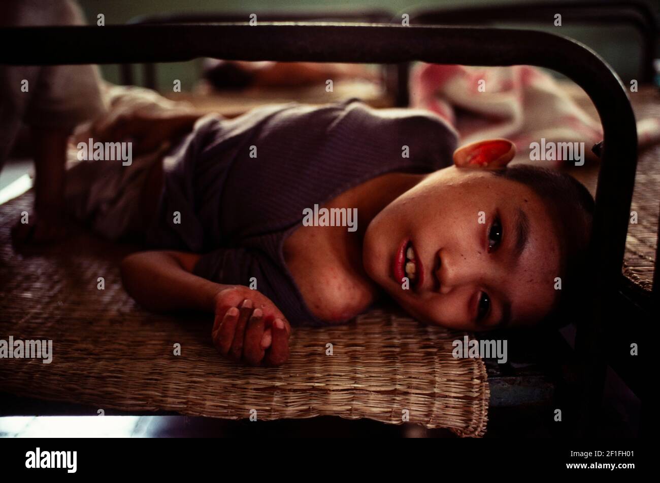 Kinder in einem Waisenhaus in Ho Chin Minh City, Südvietnam, Juni 1980 Stockfoto