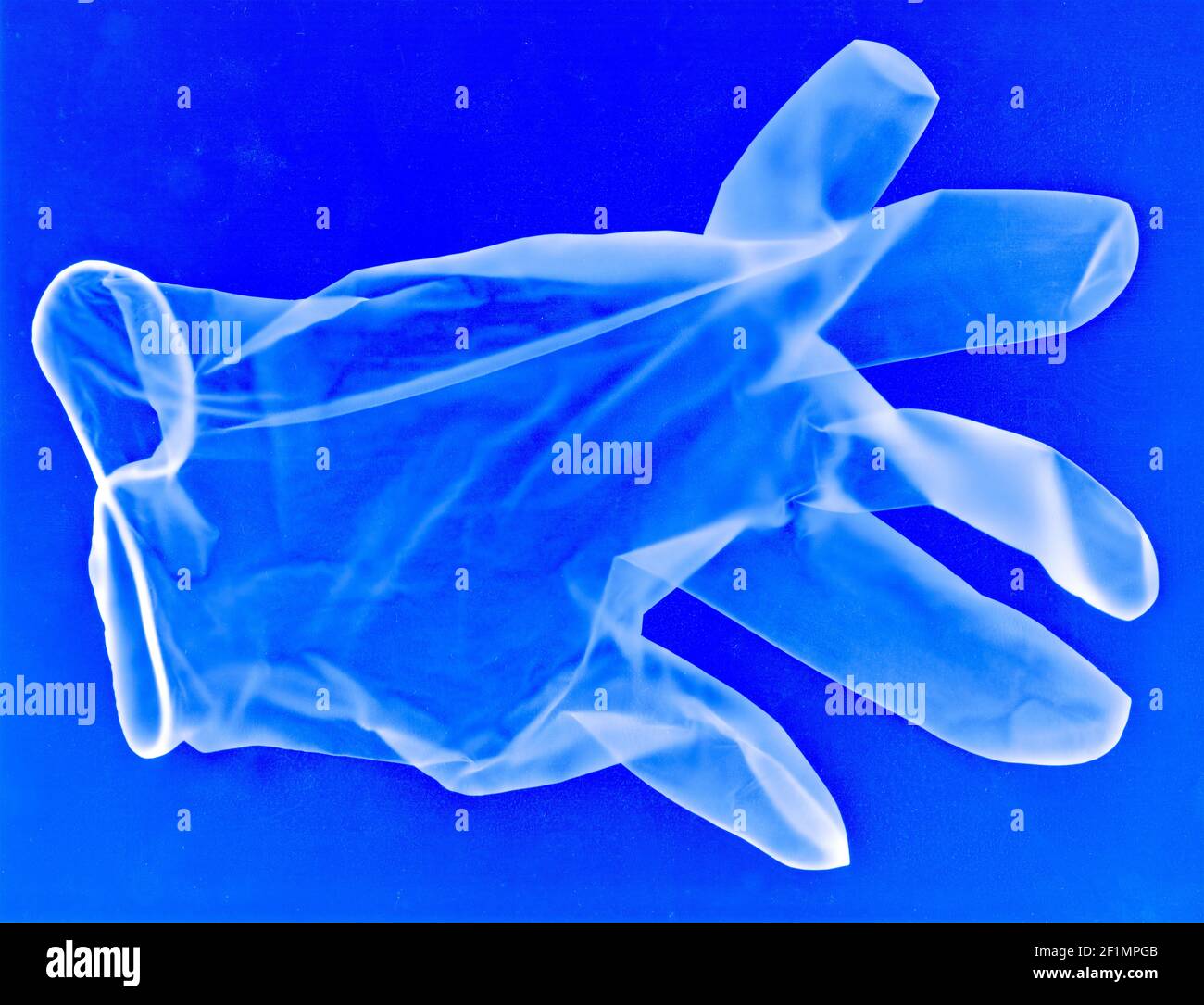 Medizinischer blauer Einweghandschuh aus Latex als Röntgenbild mit möglichen Viren, Verunreinigungen und Partikeln. Stockfoto