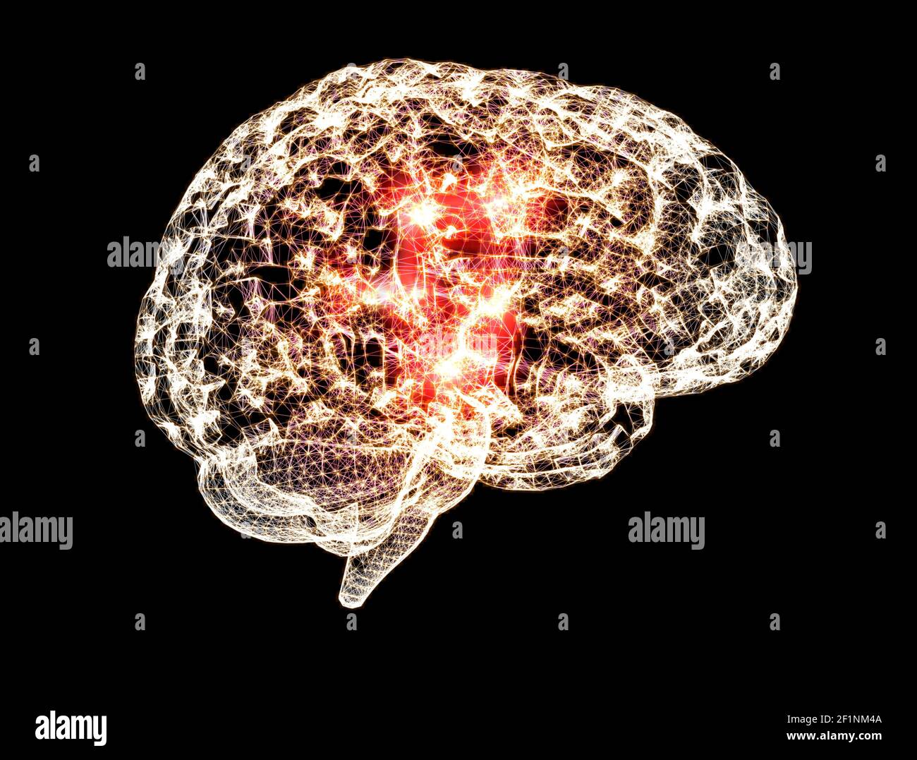 Schmerzen im Kopf, Gehirn und Synapsen, kognitive Probleme, geistige Defizite. Aneurysma. Degenerative Erkrankungen des Hirnareals. Parkinson, Schlaganfall Stockfoto