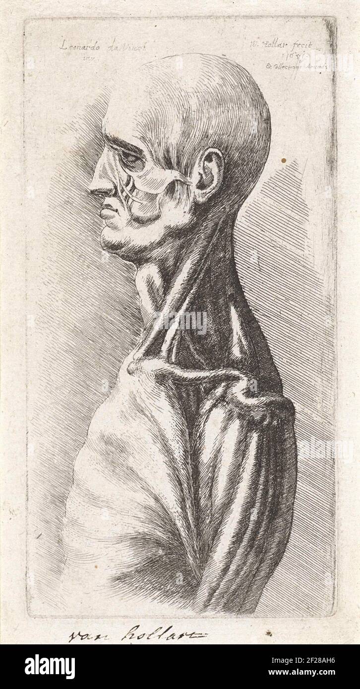 Anatomische Studie von Kopf und Schultern eines Mannes, seziert .. Stockfoto