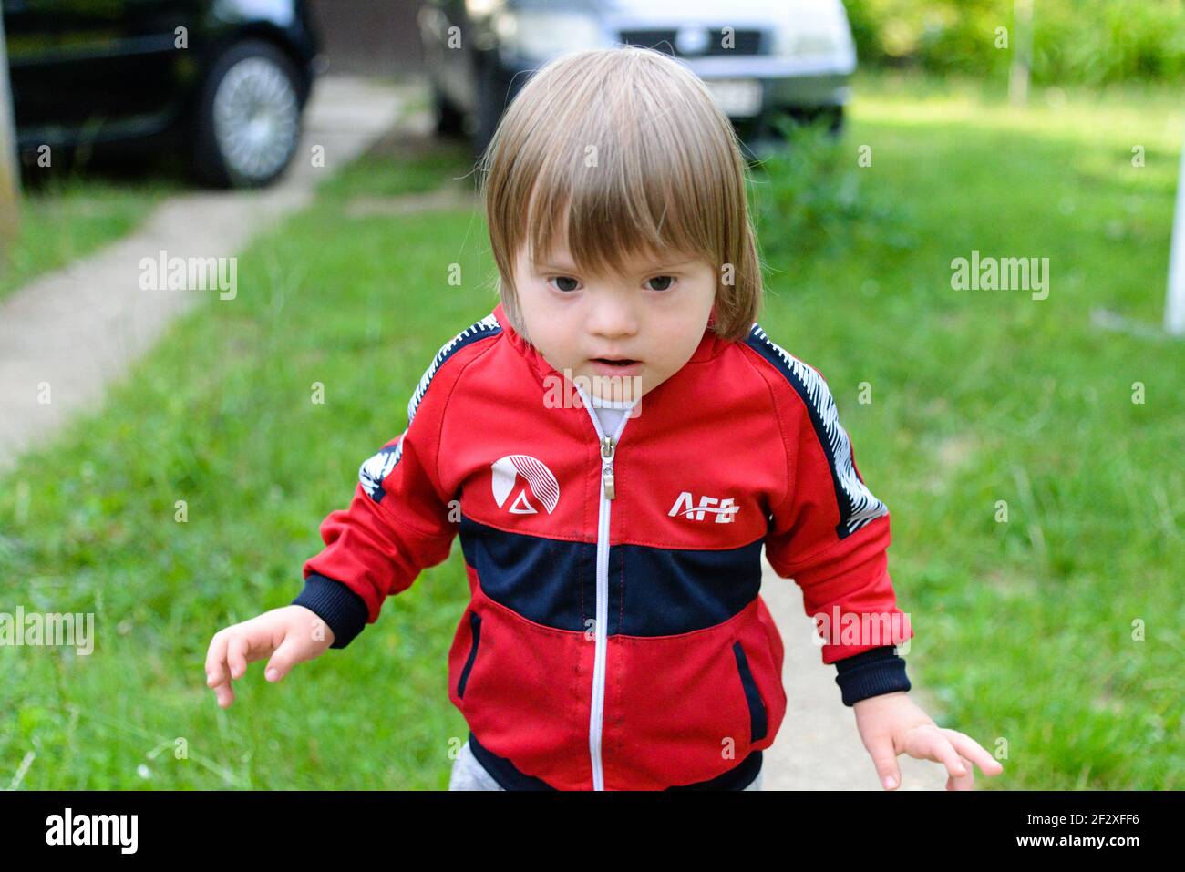 Liebenswert Down-syndrom Kind im Hof, Blick auf die Kamera. Stockfoto