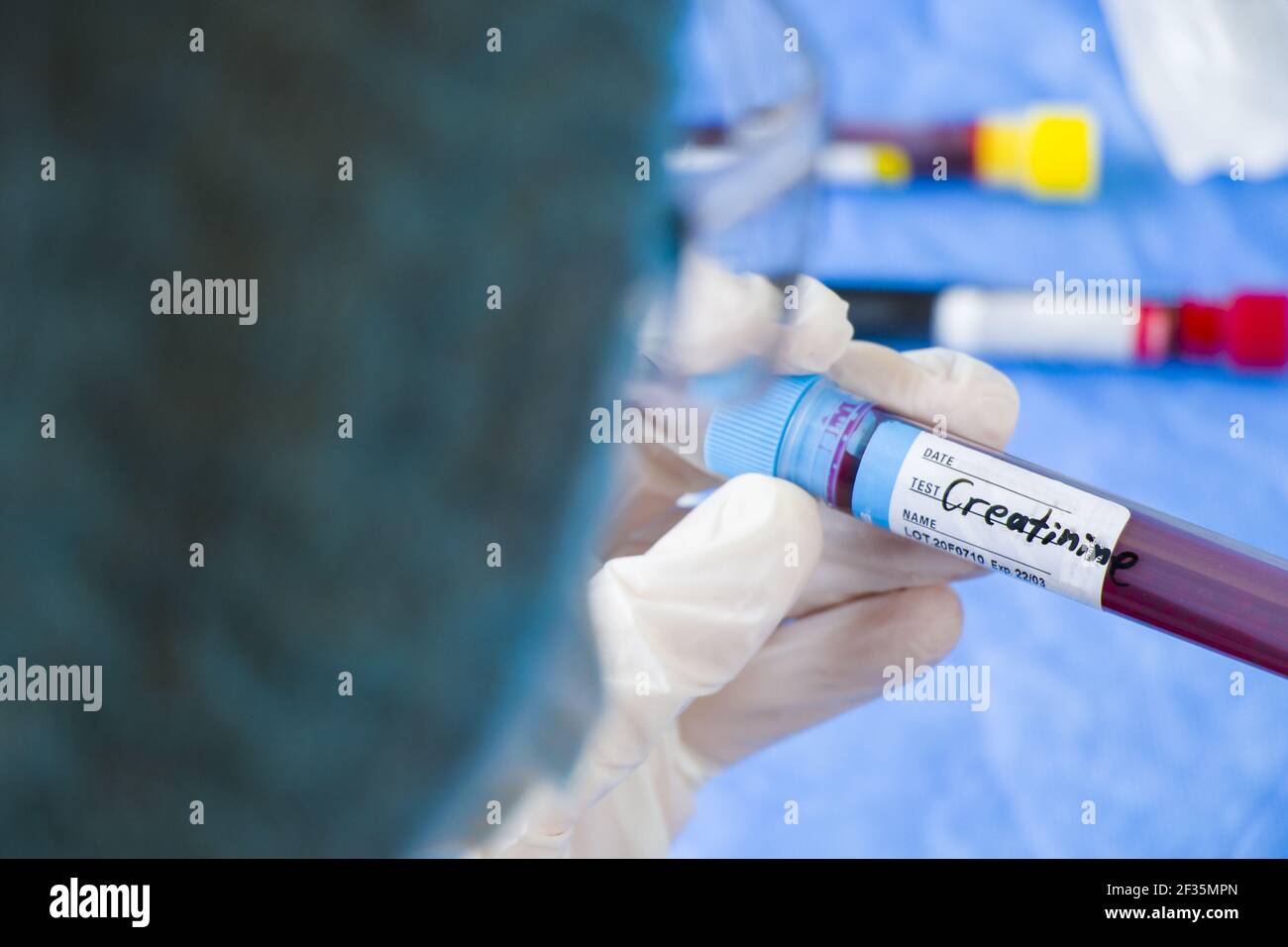 Zu Viel Kreatin Im Blut www.alamy.de