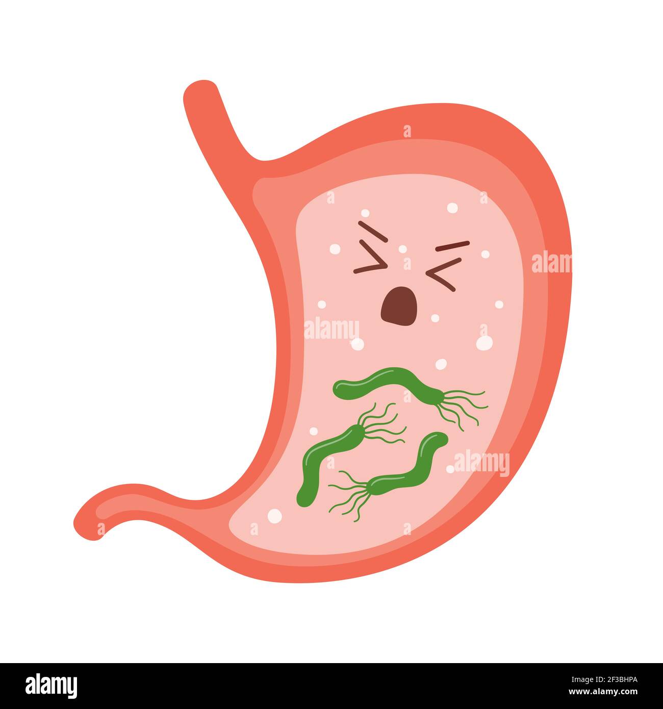 Helicobacter pylori im Magen. Kranker Magencharakter. Bakterium mit Flagella, die Gastritis verursacht. Stock Vektor