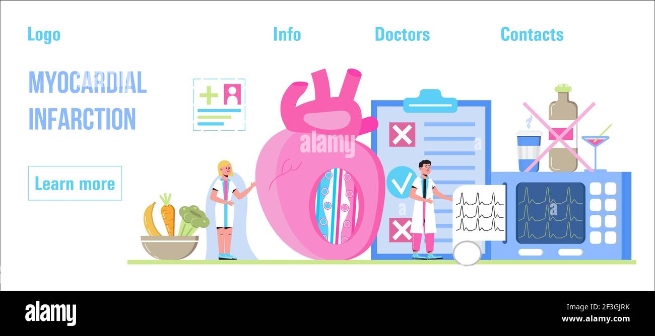 Myokardinfarkt Konzept Vektor für medizinische Website, Header, Blog. Herzinfarkt, Herzinfarkt mit winzigen Ärzten, Kardiogramm, Arterie, Herz, Stock Vektor