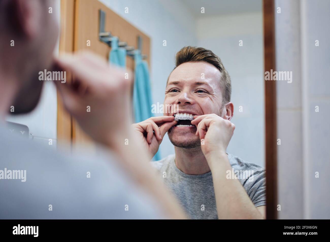Junger Mann bereitet Silikon-Tablett für Zahnaufhellung mit Bleichgel. Themen Zahngesundheit, Pflege und Schönheit. Stockfoto
