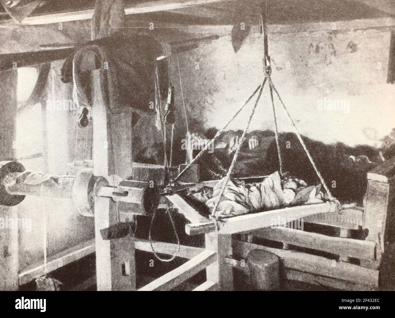 Typhus-Patienten in Russland im Jahr 1894. Stockfoto