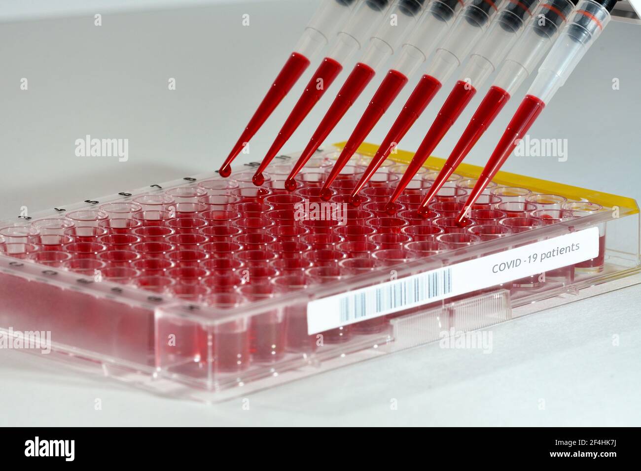 Hochdurchsatz-Screening von Covid-19-Proben mit einer Mehrkanalpipette In einer Mikrotiterplatte großen Maßstab Stockfoto