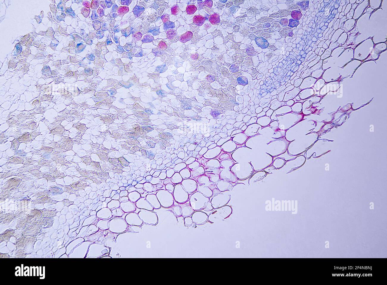 Rhizobium im Wurzelknoten unter einem Lichtmikroskop bei 10-facher Vergrößerung. Stockfoto