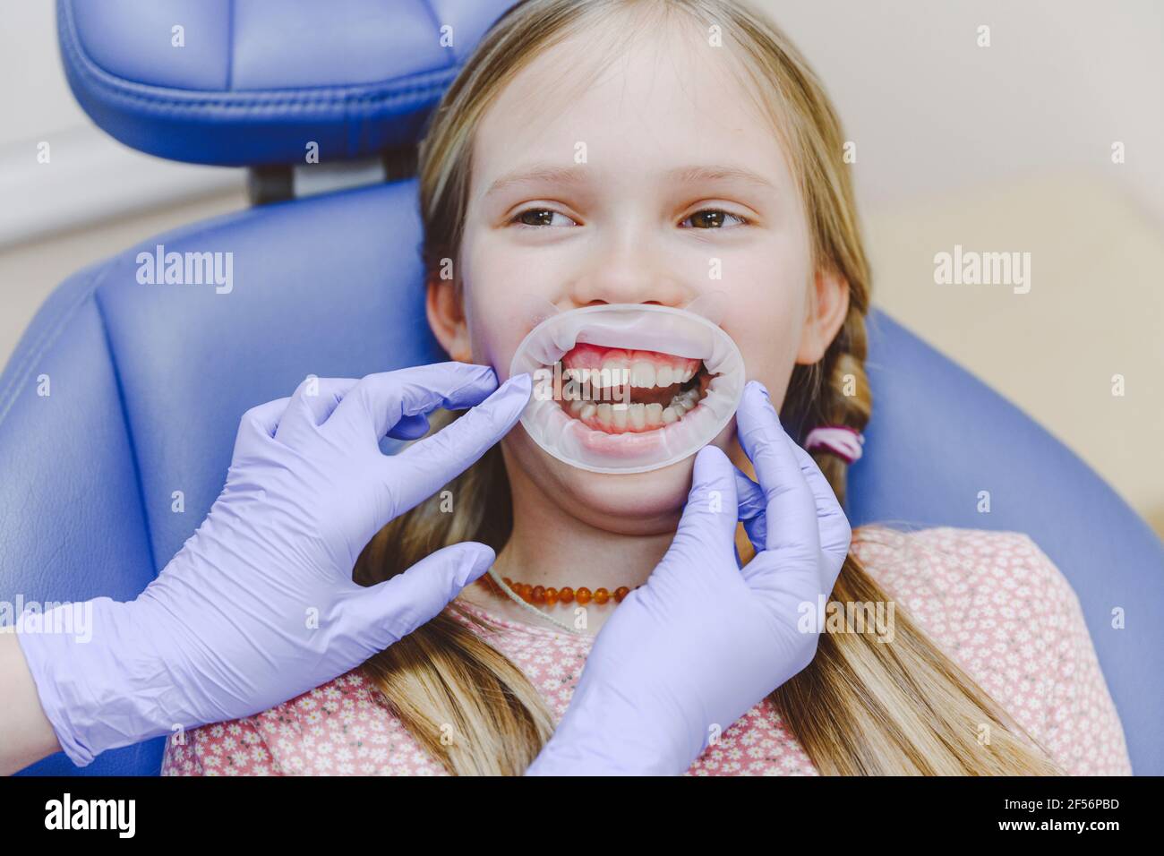 Portrait eines kleinen Mädchens, das Zahnknebel trägt und in Zahnärzten liegt Stuhl während der Prüfung Stockfoto