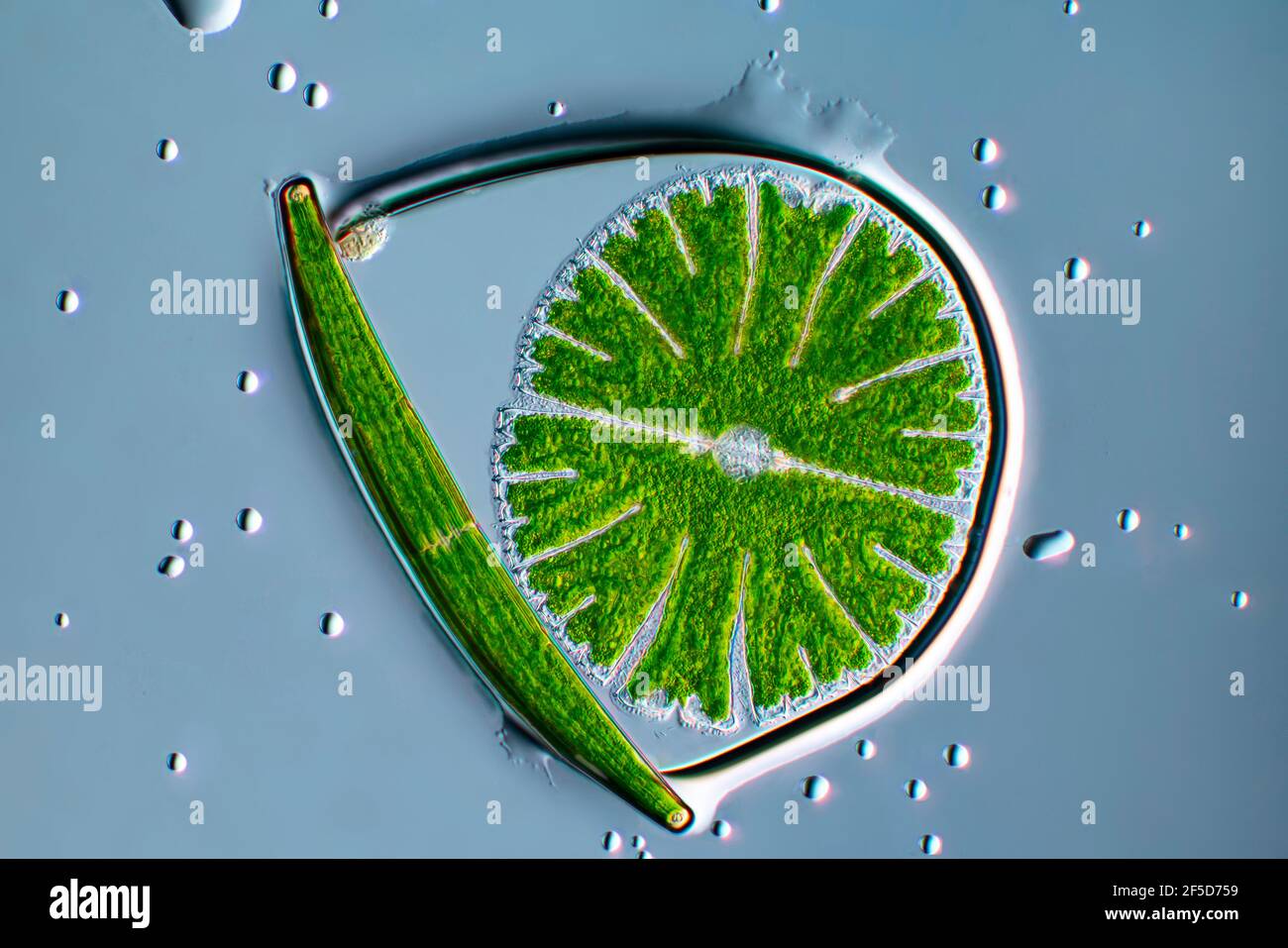 Grünalge (Micrasterias rotata), mit Clostridium in einer Wasserblase, Dunkelfeld-mikroskopisches Bild, Vergrößerung x100 bezogen auf 35 mm, Deutschland Stockfoto