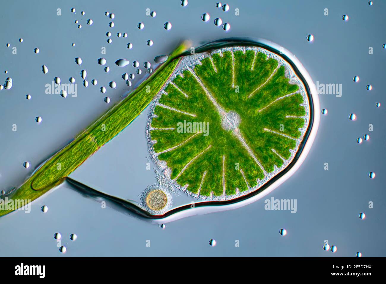 Grünalge (Micrasterias rotata), mit Clostridium in einer Wasserblase, Bild mit differenziellem Interferenzkontrast, Vergrößerung x100 bezogen auf 35 mm, Stockfoto