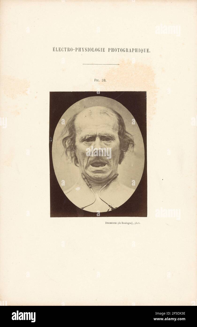 Électro-Physiologie Photographique, Abbildung 59. Stockfoto