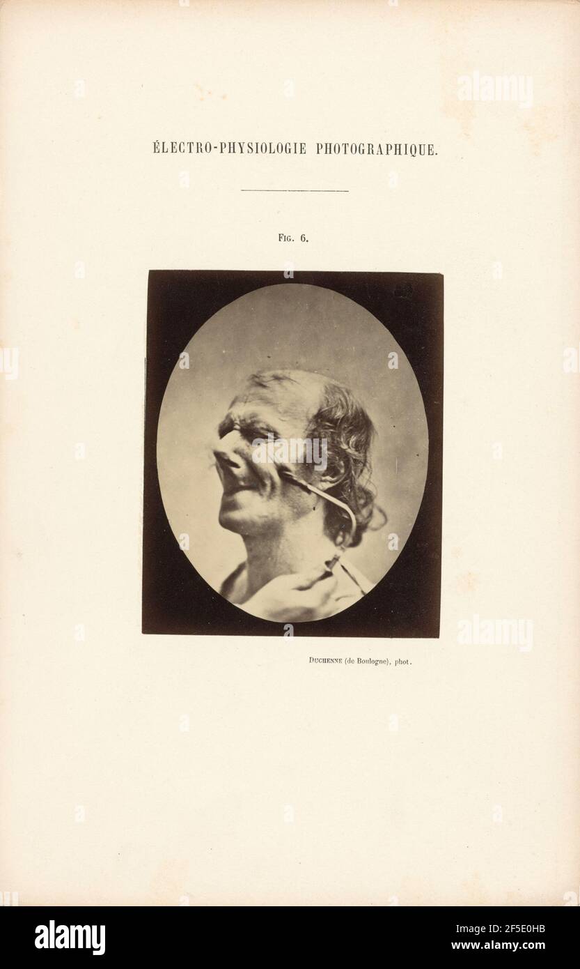 Électro-Physiologie Photographique, Abbildung 6. Stockfoto