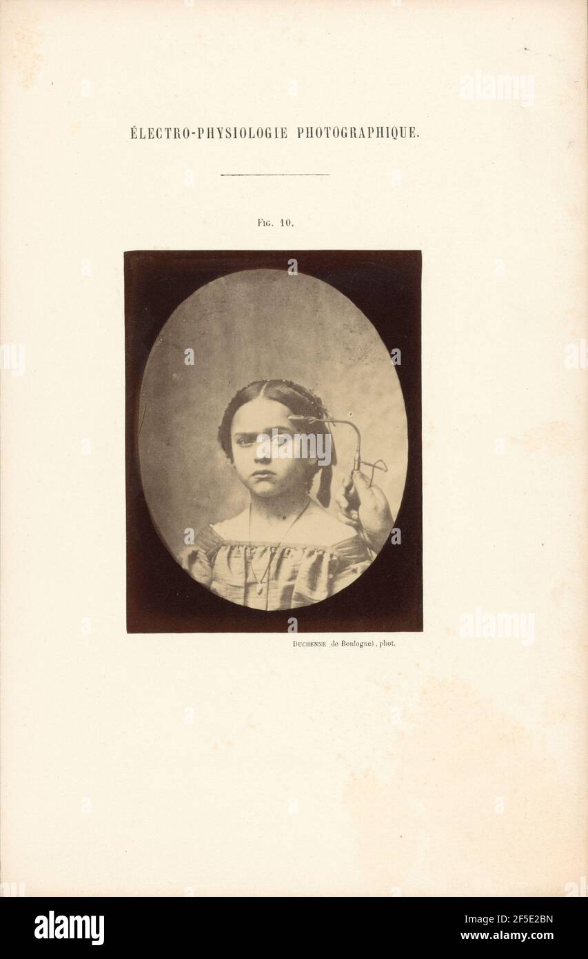 Électro-Physiologie Photographique, Abbildung 10. Stockfoto