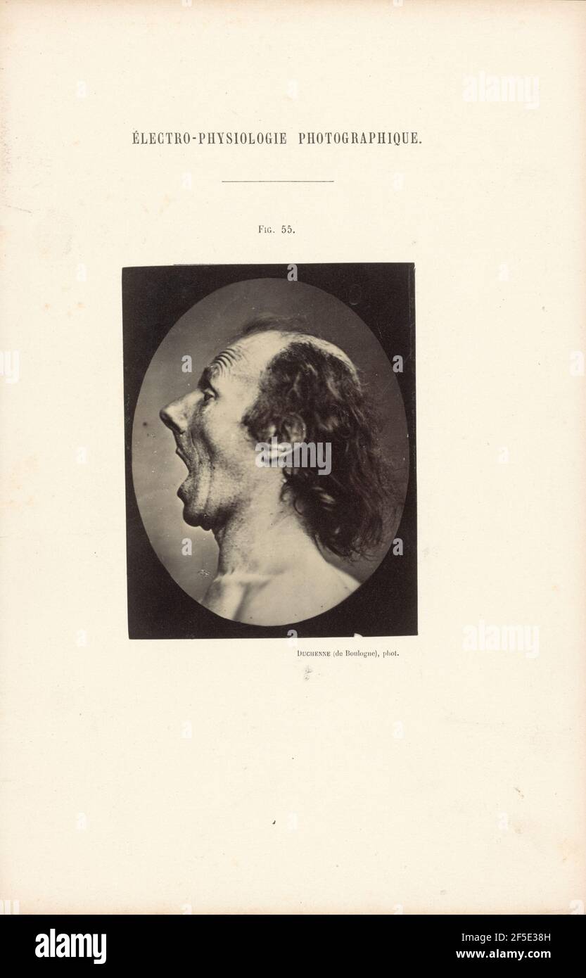 Électro-Physiologie Photographique, Abbildung 55. Stockfoto