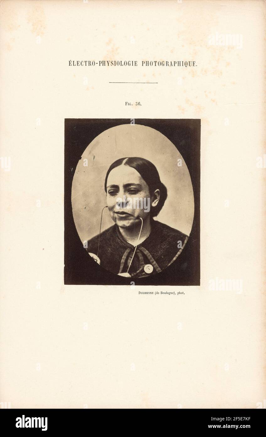 Électro-Physiologie Photographique, Abbildung 36. Stockfoto