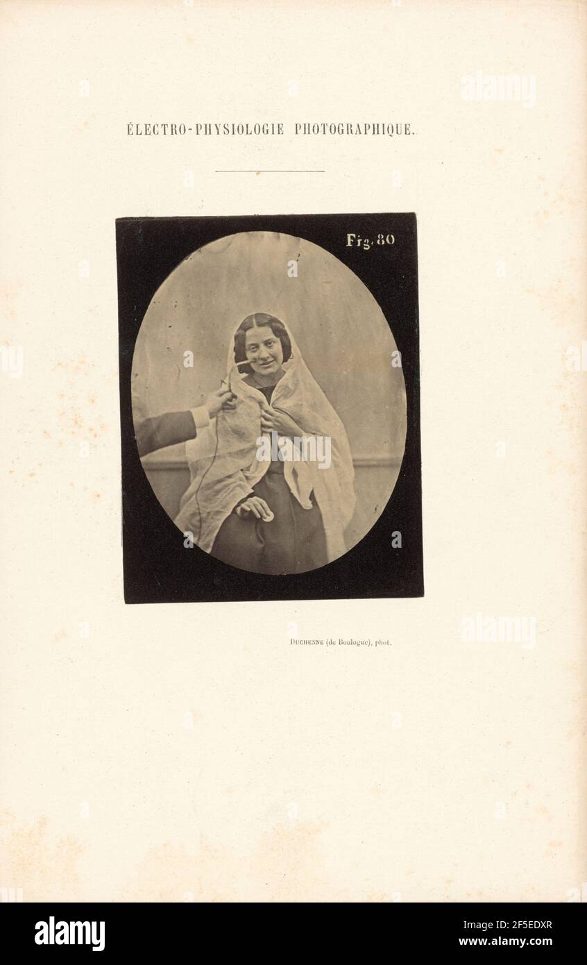 Électro-Physiologie Photographique, Abbildung 80. Stockfoto