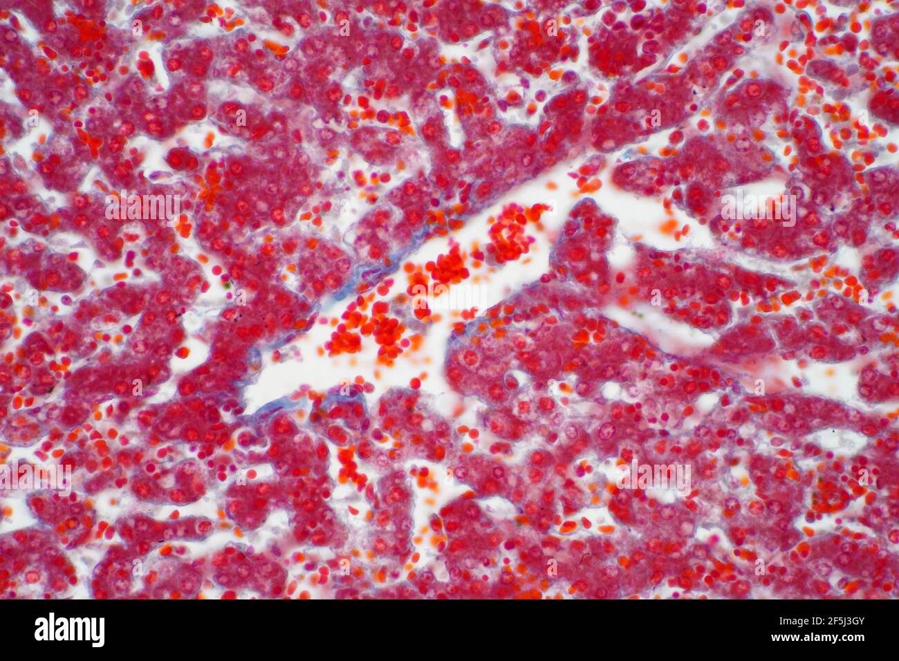 Menschliches Lebergewebe, leichte Mikrograph Stockfoto
