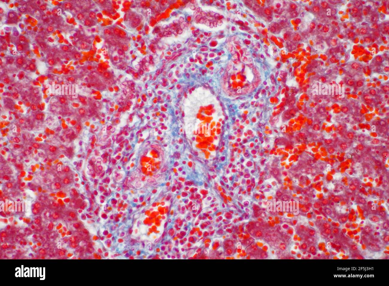 Menschliches Lebergewebe, leichte Mikrograph Stockfoto