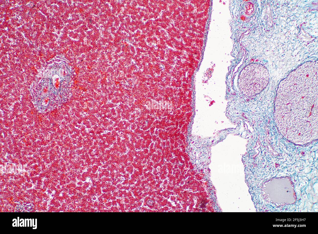 Menschliches Lebergewebe, leichte Mikrograph Stockfoto