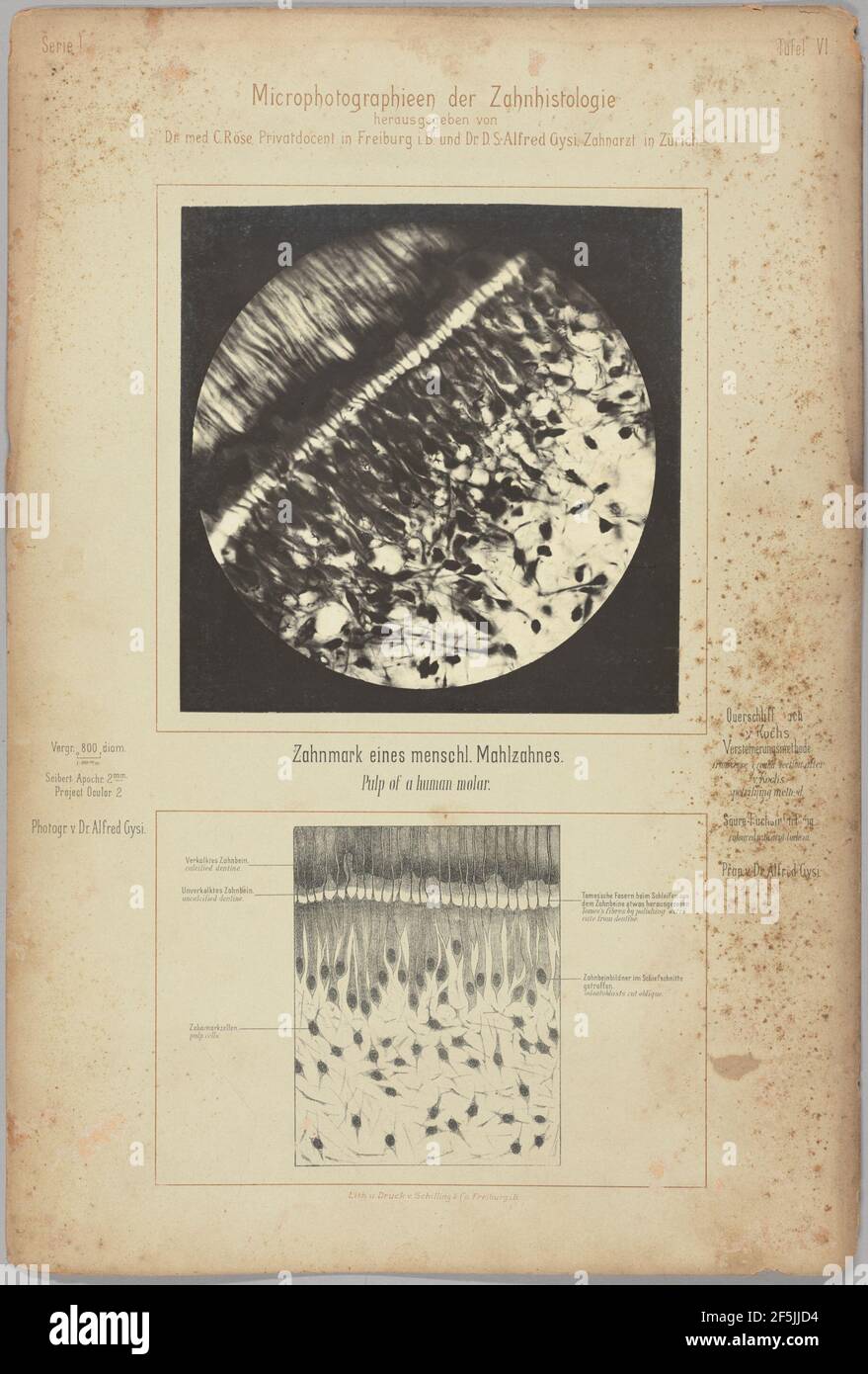 Odontoblasten, die Tomes-Fasern zeigen, die in die dentinalen Tubuli gelangen. Dr. Alfred Gysi (Schweizer, aktiv 1890s) Stockfoto