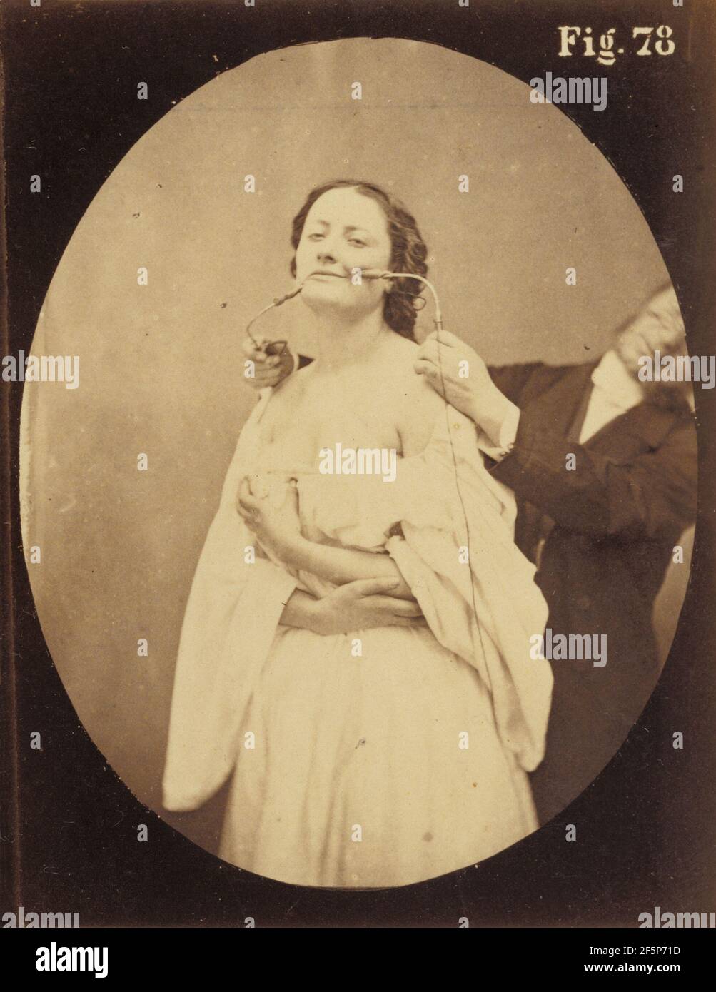 Electro-physiologie Photographique, Abb. 78. Stockfoto