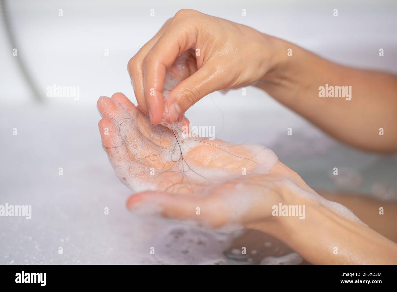 Haare fallen in den Händen nach dem Abspülen Shampoo. Stockfoto
