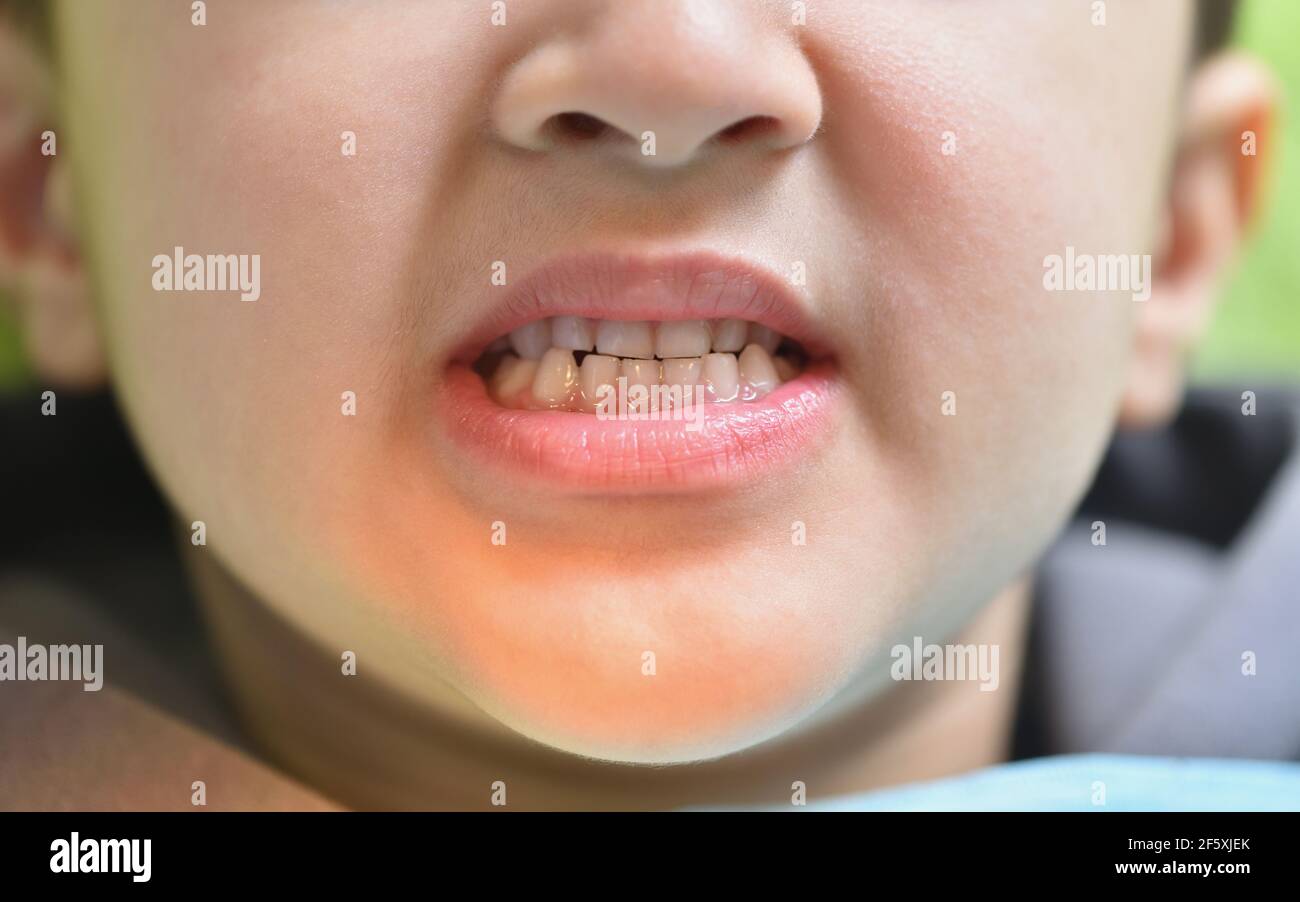 Nahaufnahme der gesunden und weißen Zähne eines Kindes am Zahnarzt zur Inspektion Stockfoto