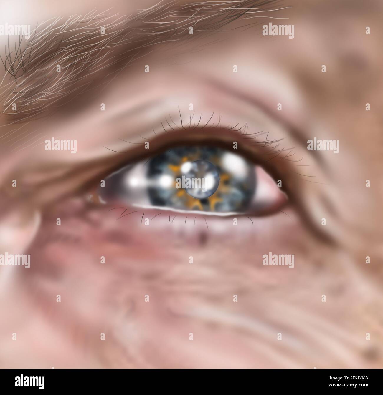 Katarakt Stockfoto