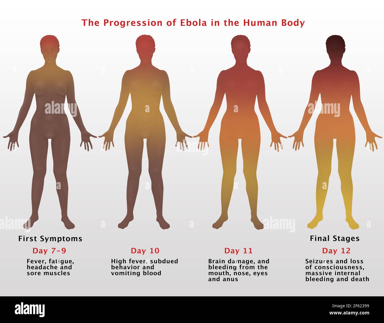Verlauf von Ebola, Illustration Stockfoto