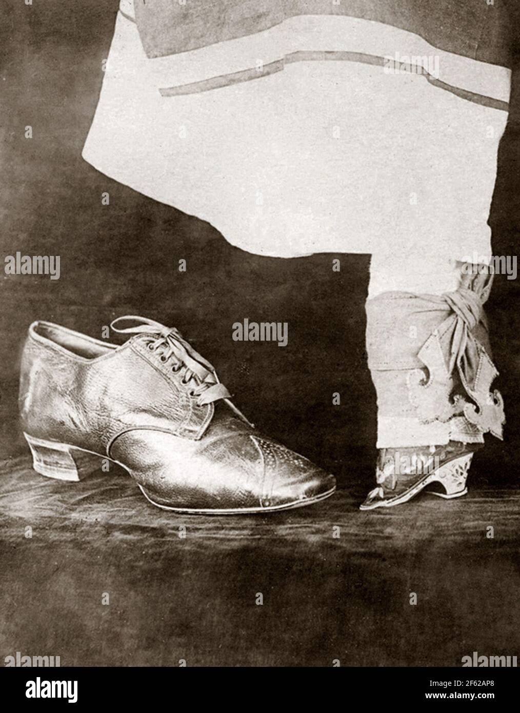 Normaler weiblicher Schuh vs. Gebundener Fuß, 1918 Stockfoto