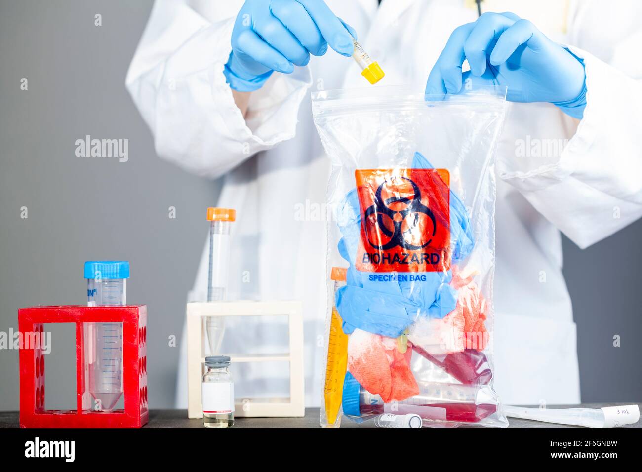 Eine Forscherin hält eine durchsichtige Plastiktüte mit aufgedrucktem Biohazard-Logo in der Hand. Der Beutel enthält potenziell gefährliche biologische Proben. Ischient Stockfoto