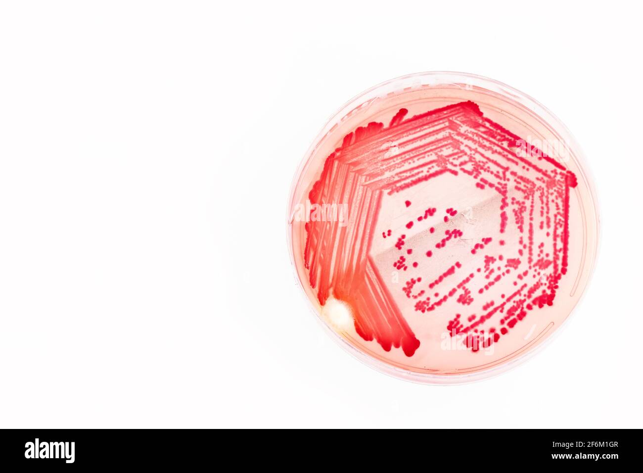 Helicobacter pylori bacteria - Draufsicht Stockfoto