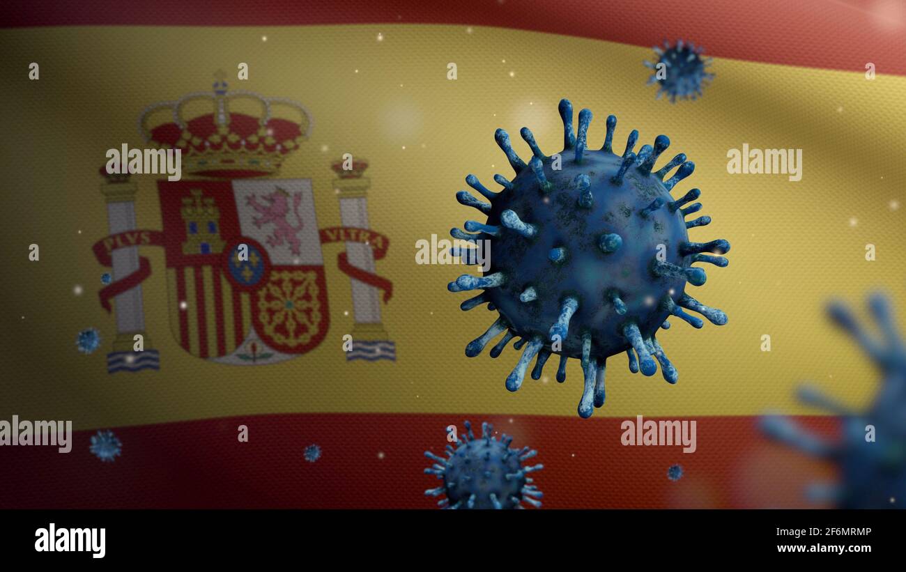 Spanische Flagge winken und Coronavirus 2019 NCoV Konzept. Asiatischer Ausbruch in Spanien, Coronaviren Influenza als gefährliche Grippesteimpffälle wie eine Pandemie. M Stockfoto