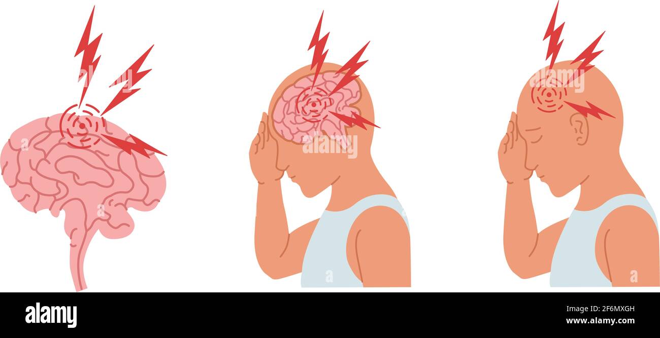 Vektordarstellung einer Person, die Kopfschmerzen und Entzündungen des menschlichen Gehirns hat. Stock Vektor