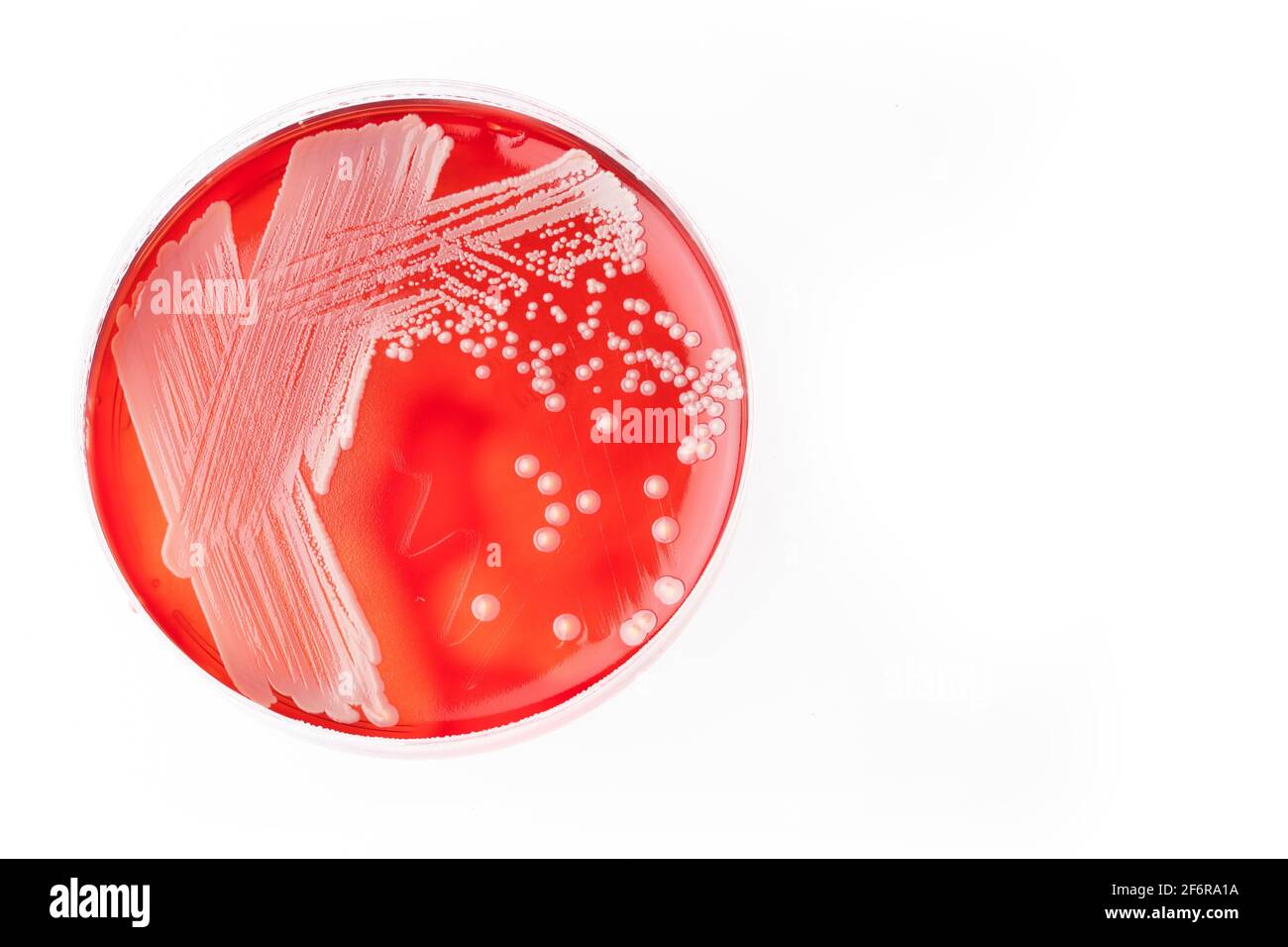 Staphylococcus aureus - Bakterienkulturen. Weißer Hintergrund Stockfoto