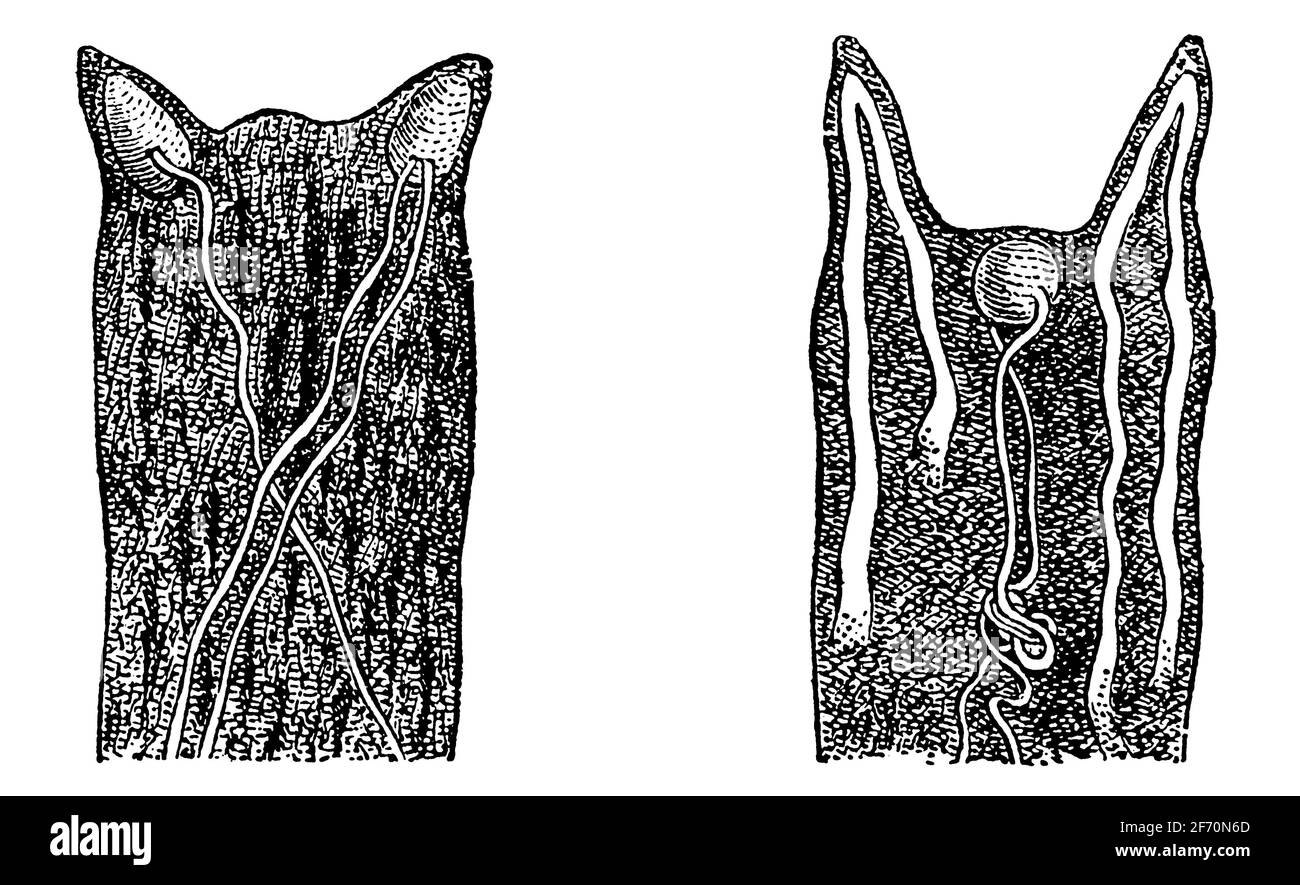 Doppelte Papillen der Lippen des Menschen. Illustration des 19. Jahrhunderts. Deutschland. Weißer Hintergrund. Stockfoto