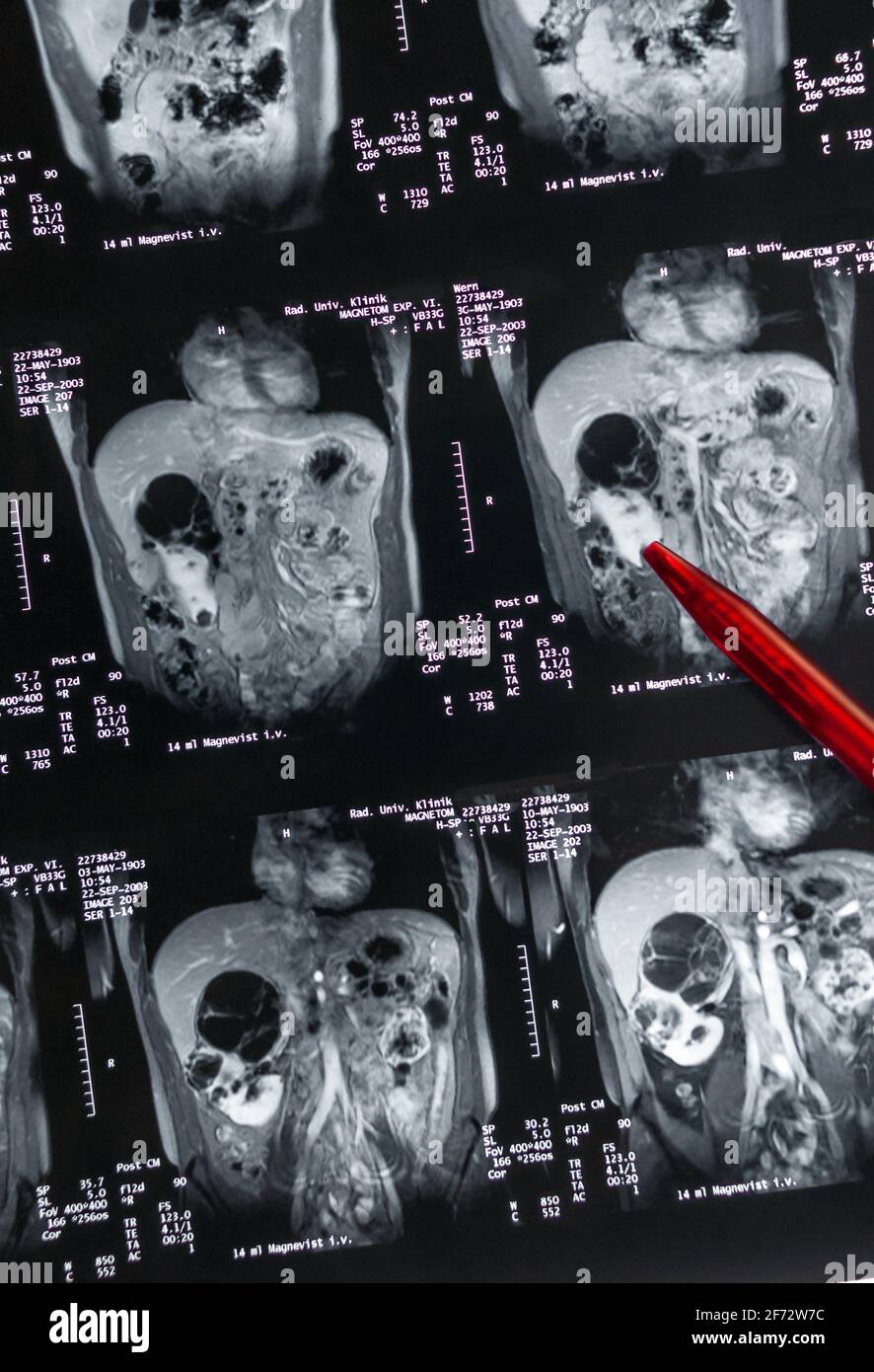 Anatomie des menschlichen beckens -Fotos und -Bildmaterial in hoher ...