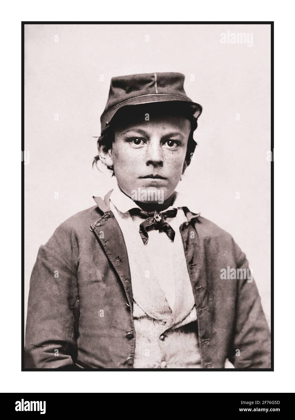 American Civil war junger Teenager-Soldat in der Uniform der Infanterie der Confederate States Army zeigt einen jungen Soldaten, möglicherweise einen Schlagzeugjungen. Datum 1861-1865 Tinnyp, Ferrotyp Stockfoto