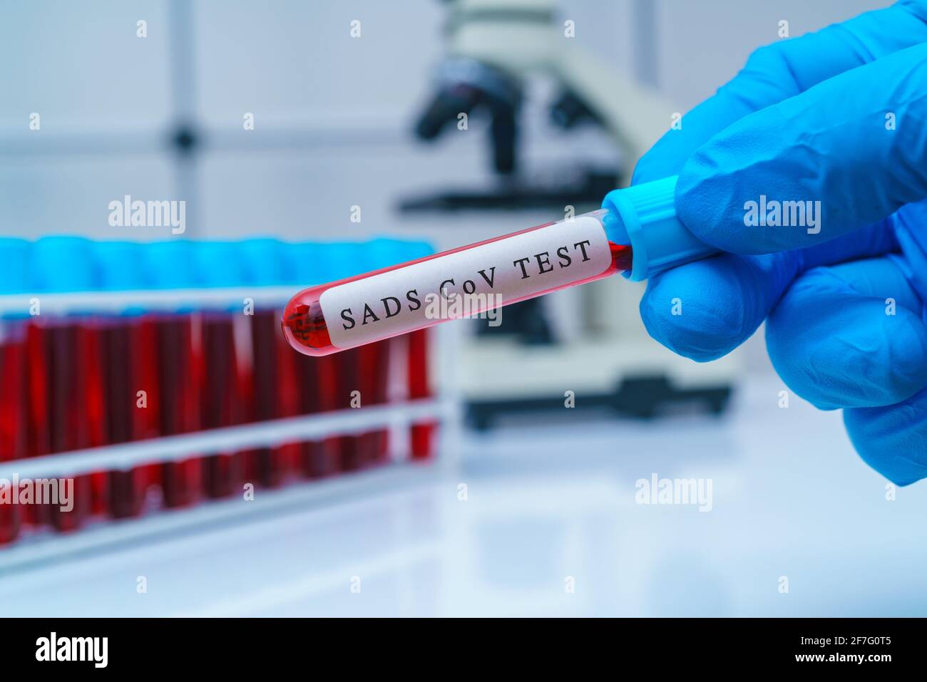 Reagenzglas für Test SADS-CoV. Schweine-akutes Durchfallsyndrom Coronavirus ist ein Coronavirus, das mit dem Rhinolophus bat Coronavirus HKU2 zusammenhängt Stockfoto