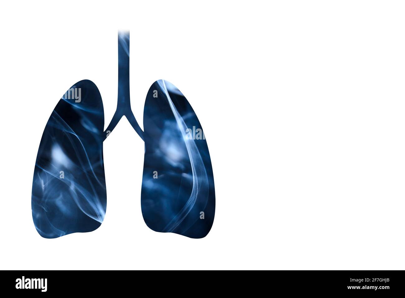 Lungen voller Rauch. Horizontales Bild mit weißem Hintergrund und Kopierbereich. Konzepte des Welt-No-Tobacco-Tages, Raucherentwöhnung und Gesundheit. Stockfoto Lungen voller Rauch. Horizontales Bild mit weißem Hintergrund und Kopierbereich. Konzepte des Welt-No-Tobacco-Tages, Raucherentwöhnung und Gesundheit. Stockfoto