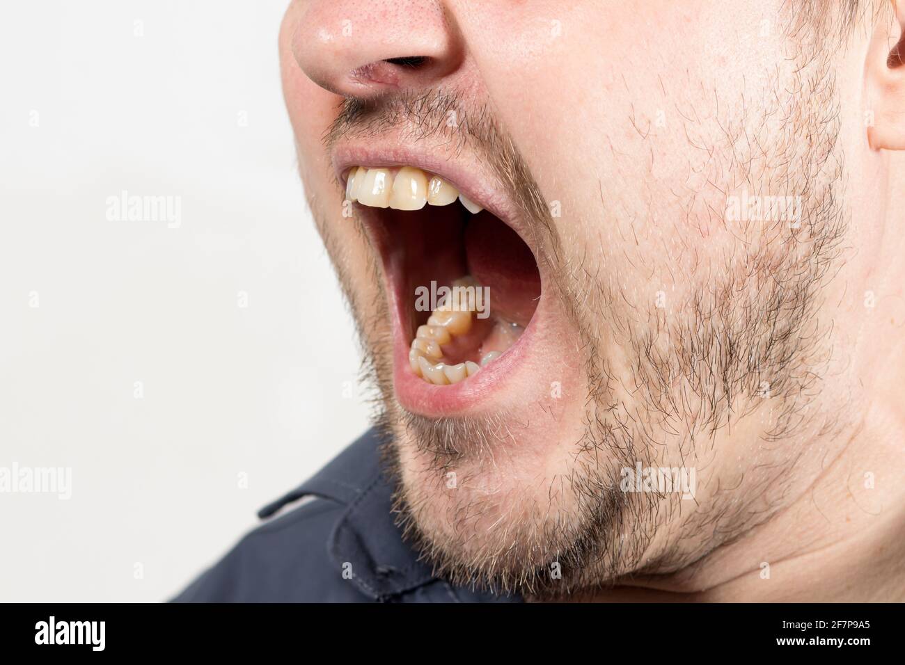 Ein wütender, aggressiver Mann schreit mit offenem Mund. Ein menschlicher Schrei nach einem Kind oder ein Streit in der Familie. Wut und negative Emotionen mit Schreien. Stockfoto